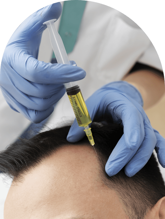 PRP Hair Treatment