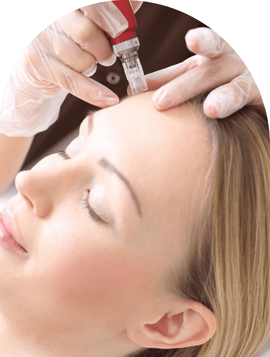 Mesotherapy Treatment