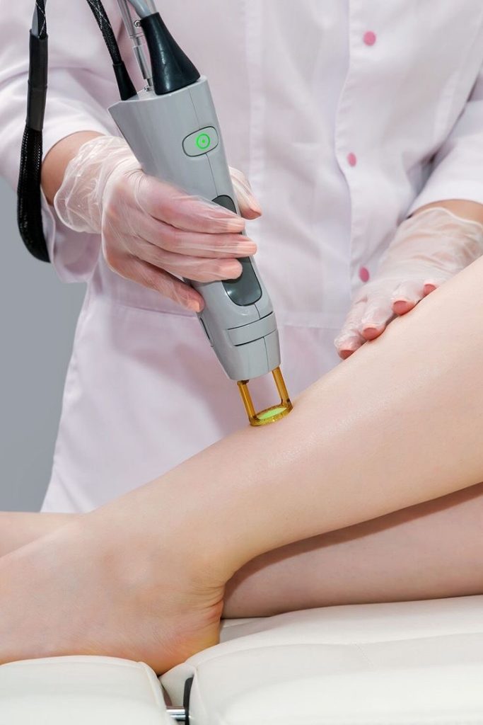 Laser Hair Removal