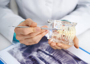 Wisdom Teeth Removal