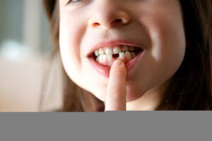 Missing Teeth