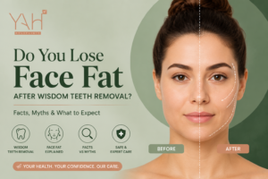 Do you lose face fat after wisdom teeth removal
