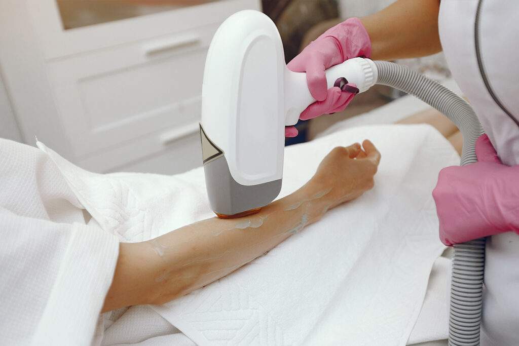 Laser Hair Removal