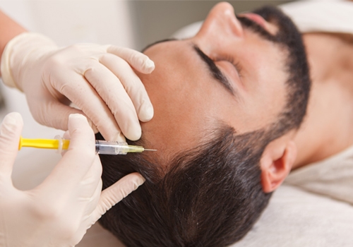 PRP Hair Treatment Preparation