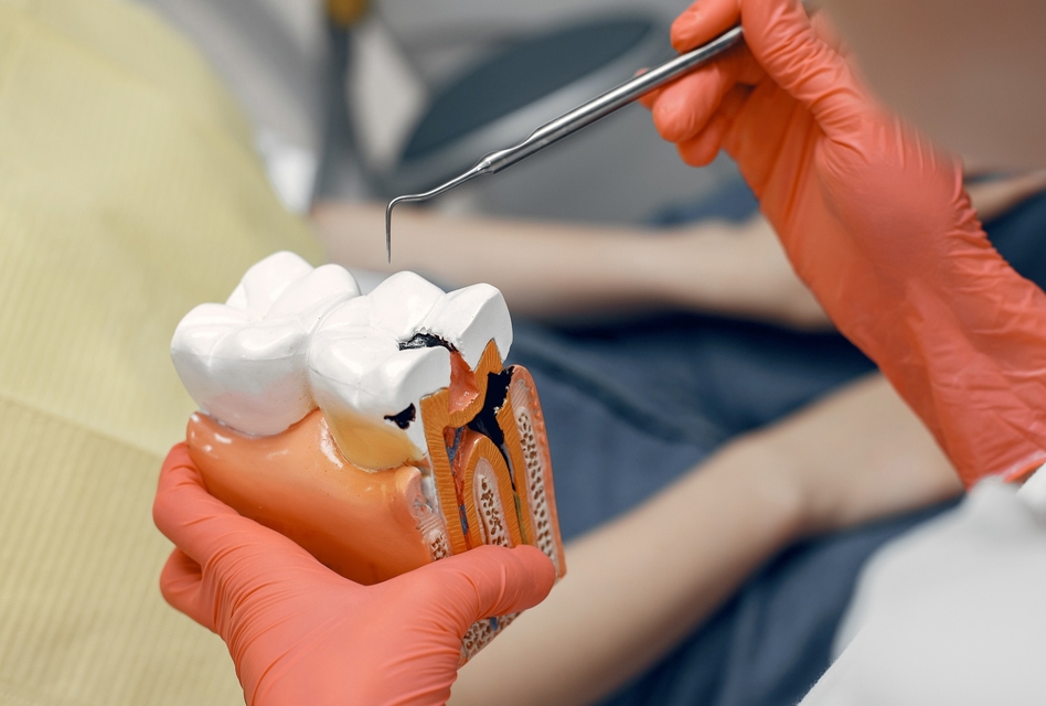Root Canal Treatment