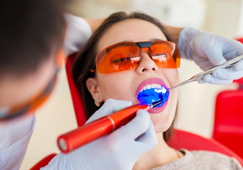 Teeth Whitening Treatment Bright Results, No Stress