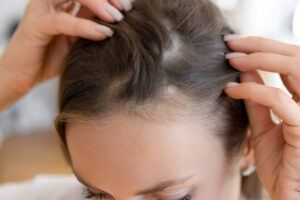 Hair Growth