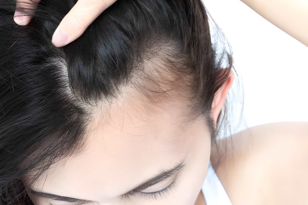 Best Treatment for Hair Growth